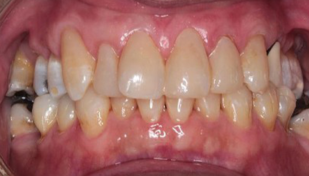 After - Kirby Dental