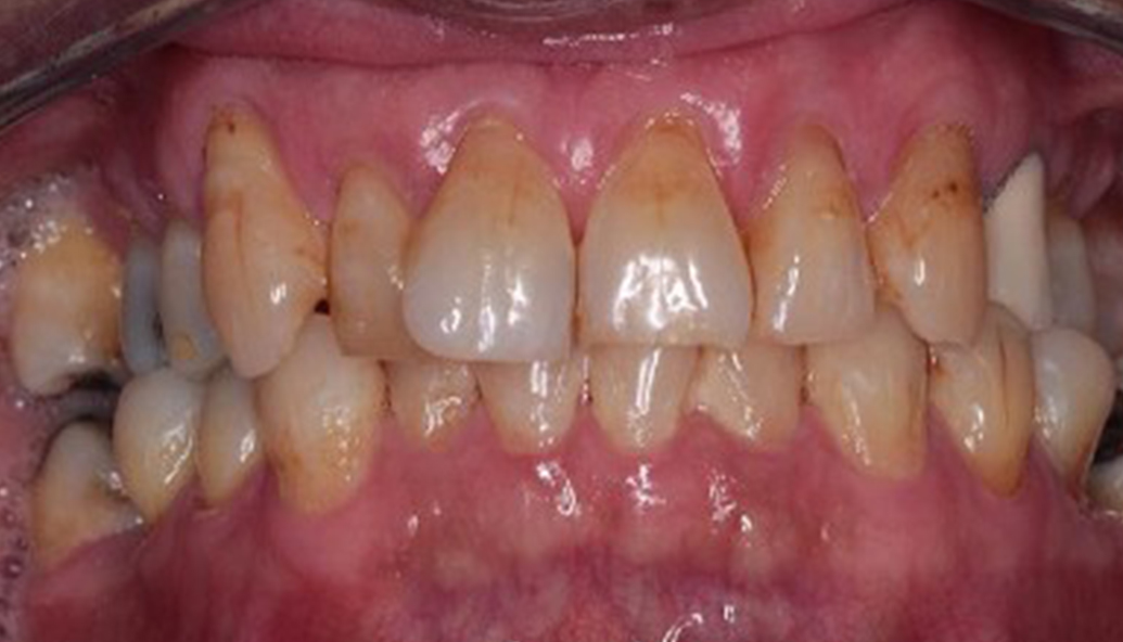 Before - Kirby Dental