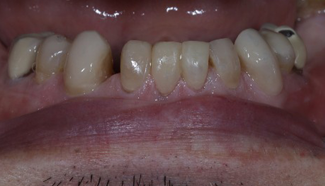 After - Kirby Dental