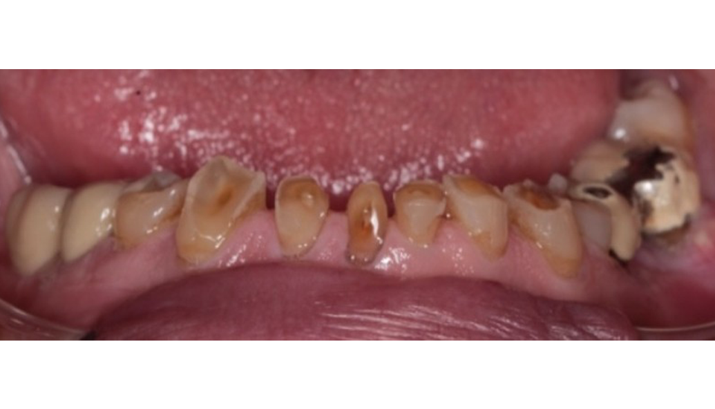 Before - Kirby Dental