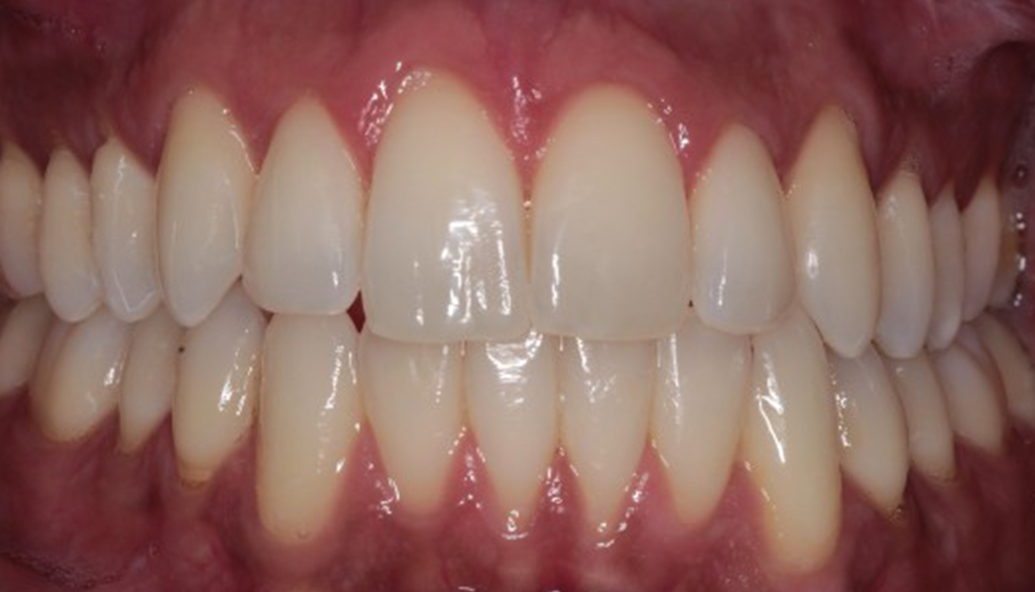 After - Kirby Dental