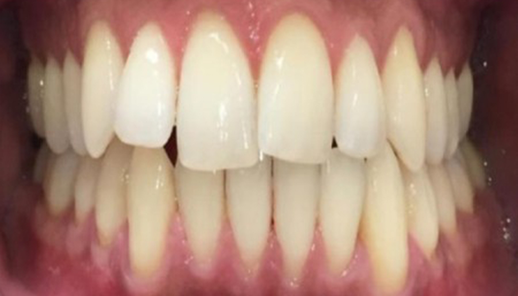 Before - Kirby Dental