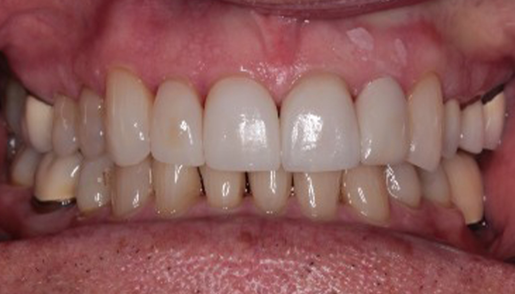 After - Kirby Dental