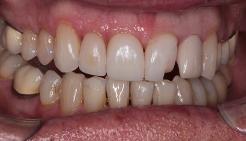 Before - Kirby Dental