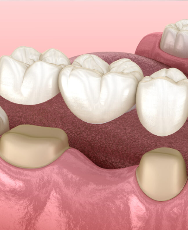 Treatments - Kirby Dental