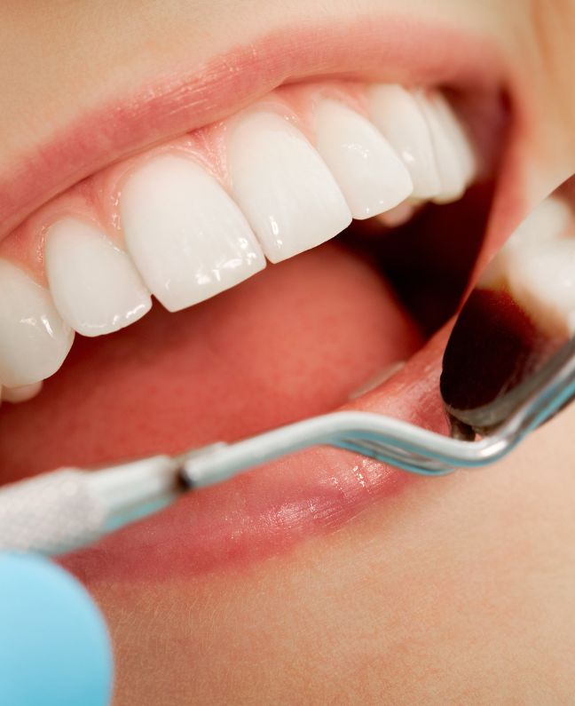 Treatments - Kirby Dental