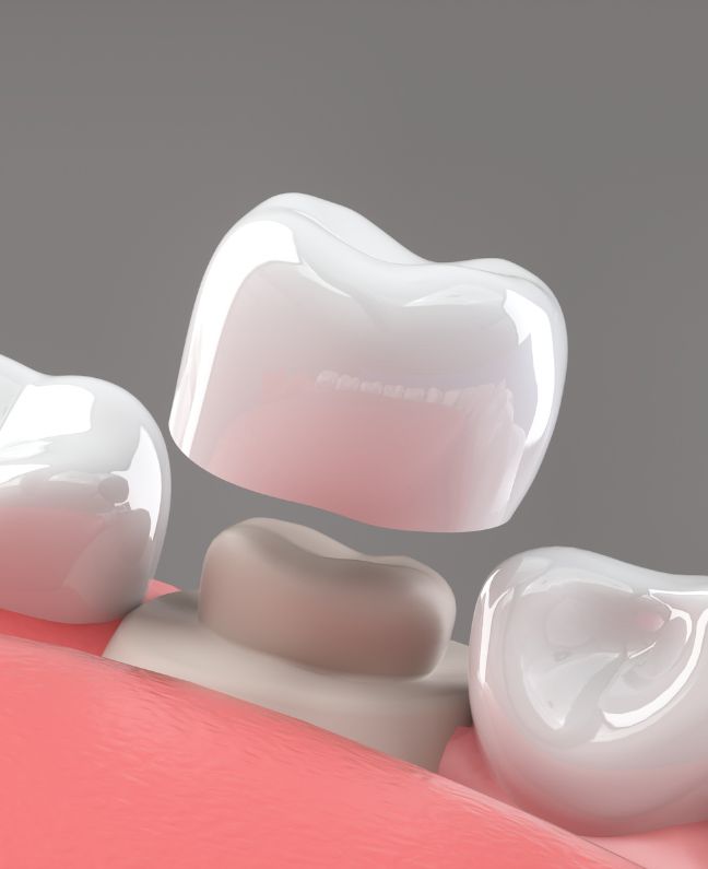 Treatments - Kirby Dental