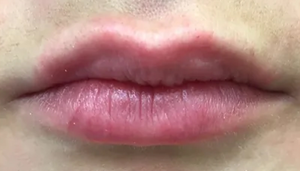 After - Kirby Dental