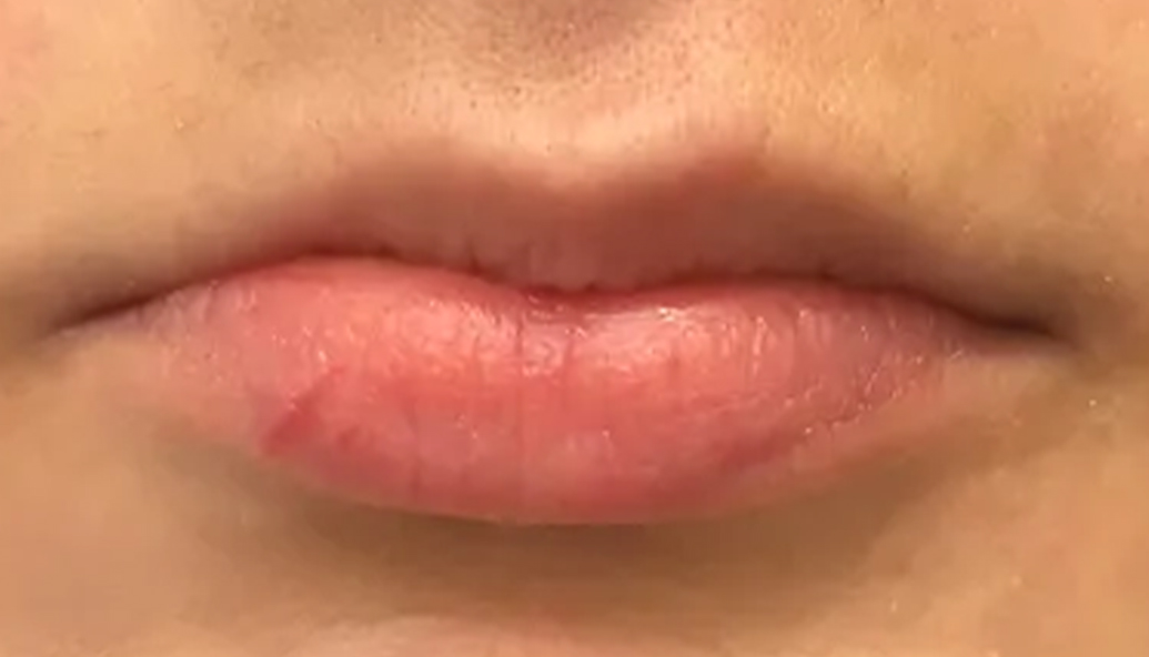 Before - Kirby Dental