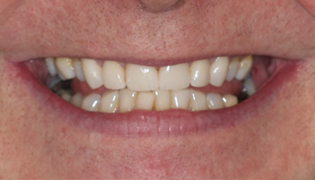 After - Kirby Dental