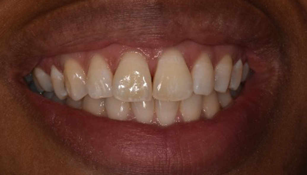 After - Kirby Dental