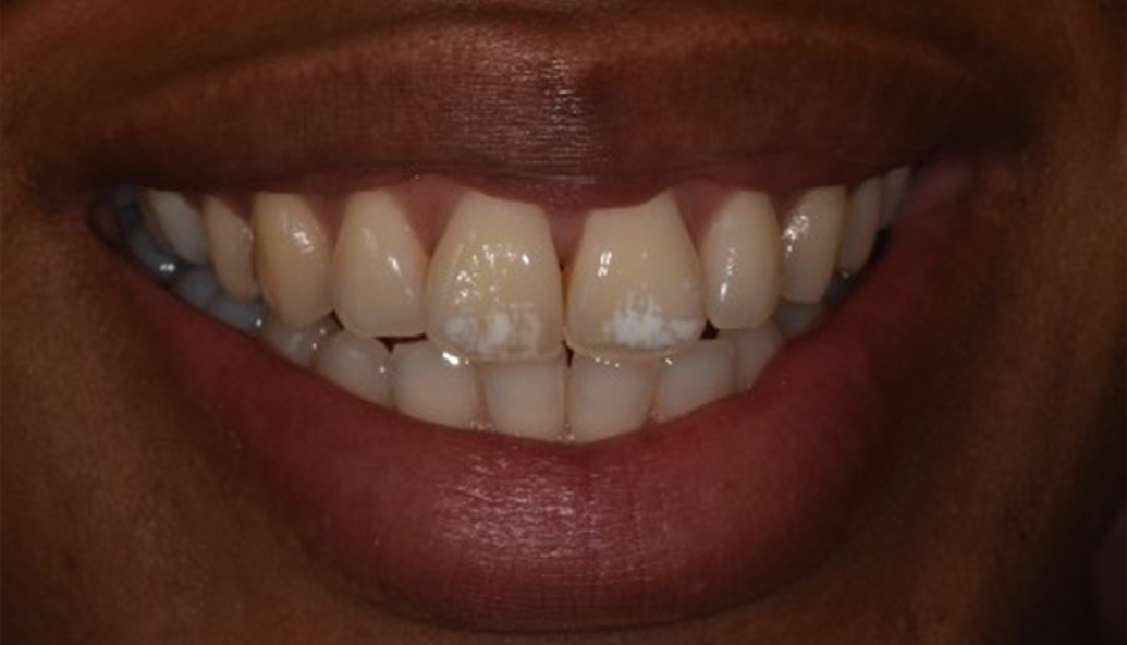 Before - Kirby Dental