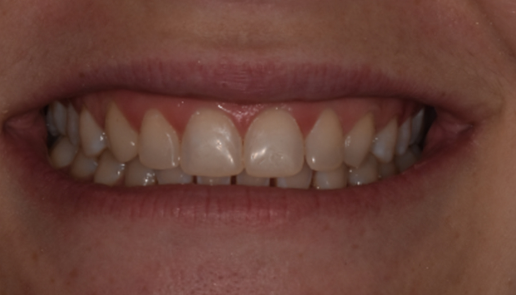 After - Kirby Dental