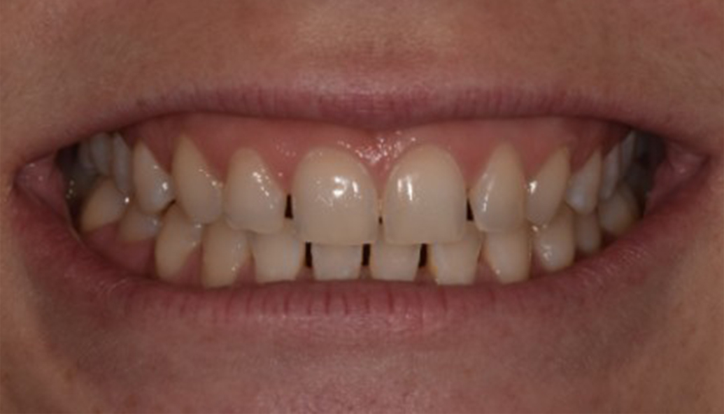 Before - Kirby Dental