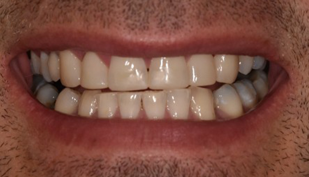 After - Kirby Dental