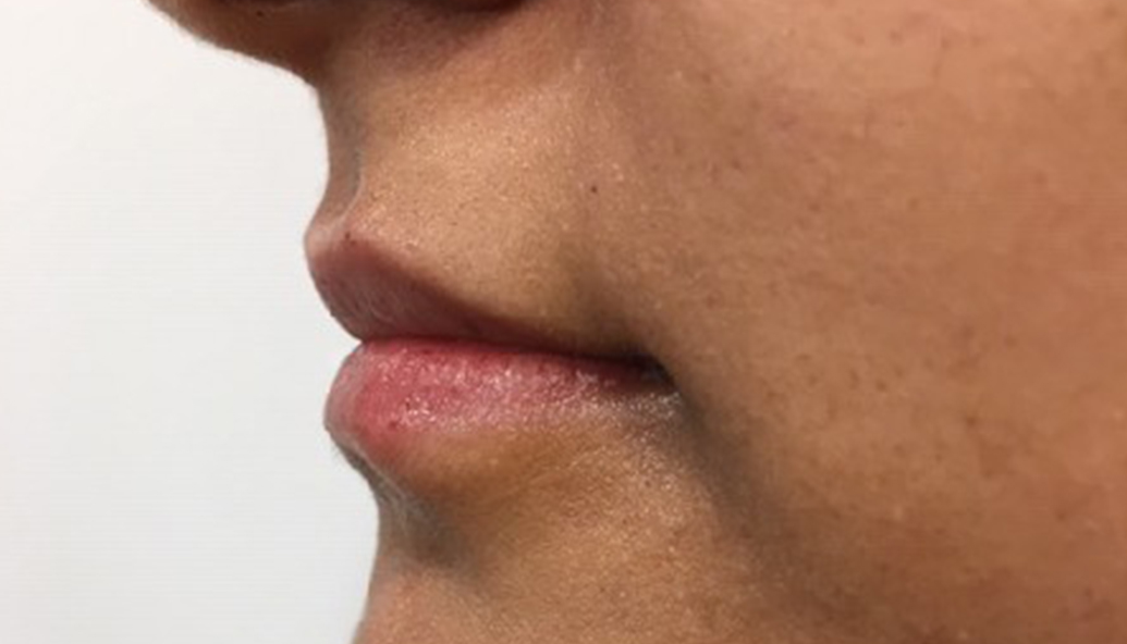 After - Kirby Dental