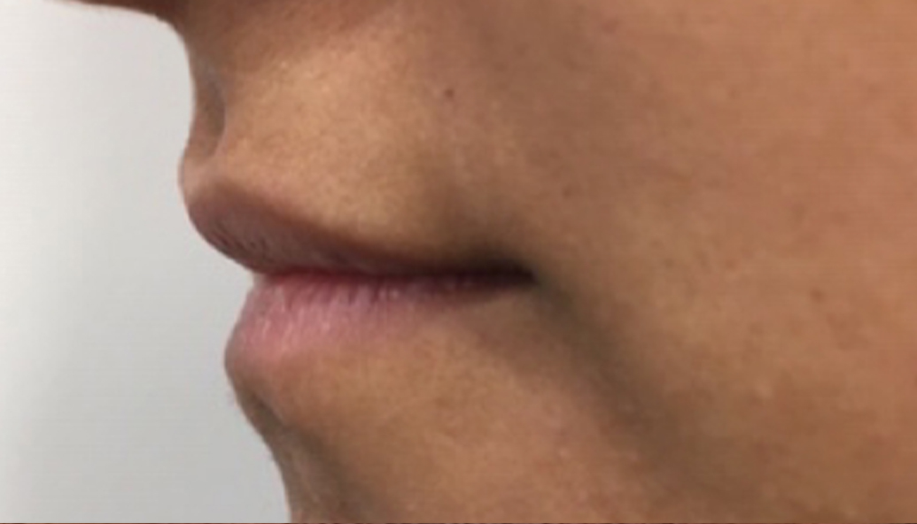 Before - Kirby Dental