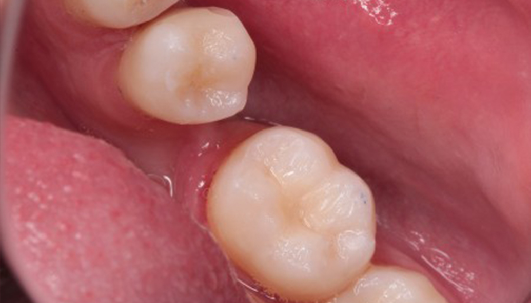 After - Kirby Dental