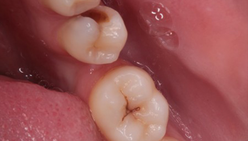 Before - Kirby Dental