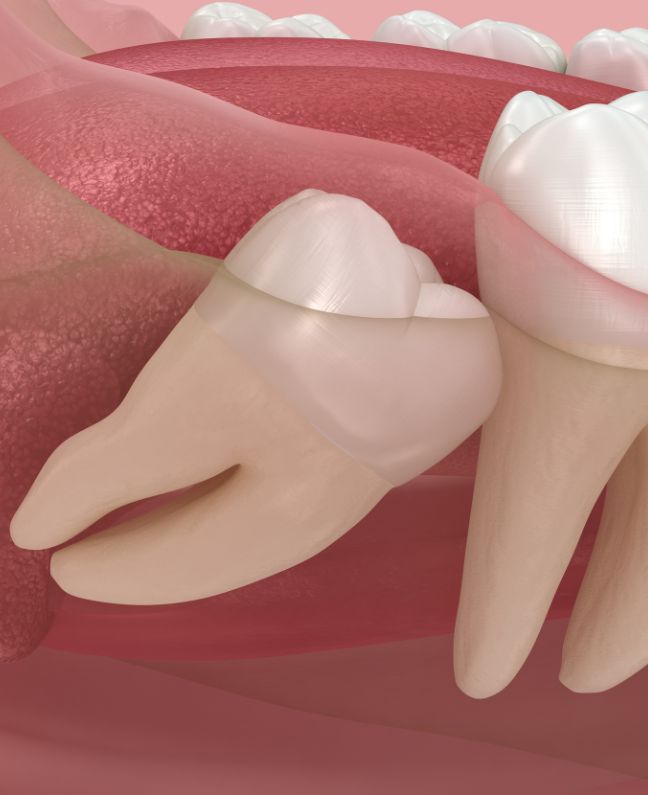 Treatments - Kirby Dental