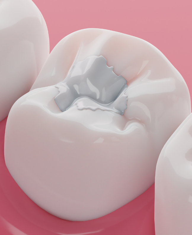 Treatments - Kirby Dental