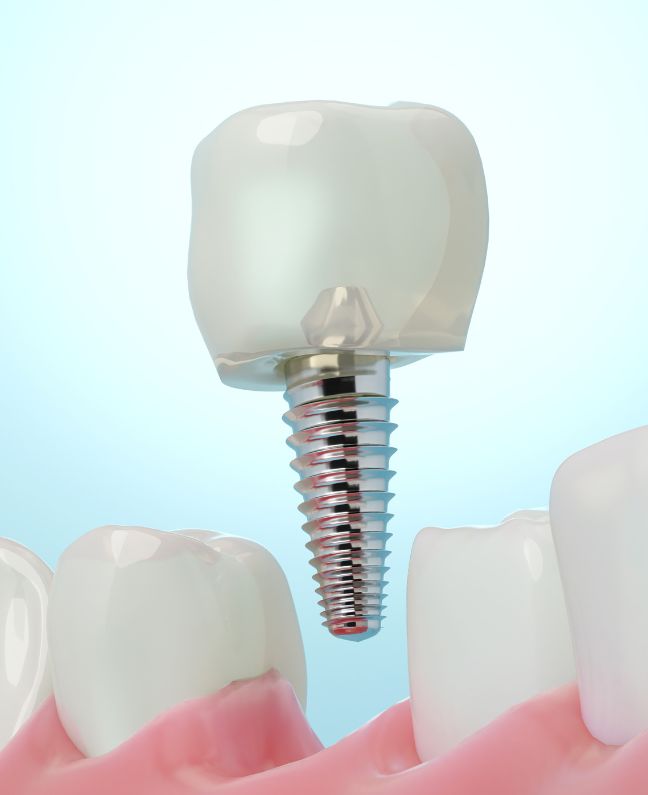 Treatments - Kirby Dental