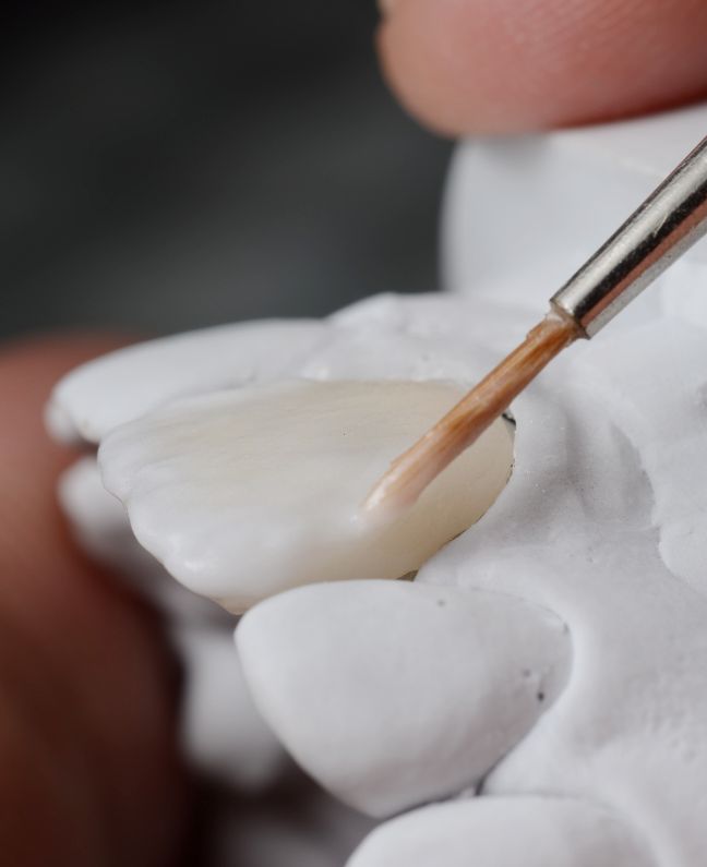 Treatments - Kirby Dental