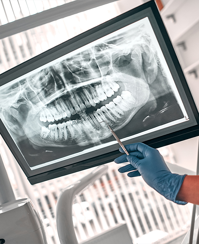 Treatment-Category - Kirby Dental